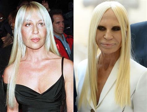 donatella versace 2014|donatella versace before and after surgery.